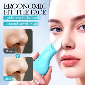 SADOER Ergonomics Blackhead Spatula (NO.SD08170) - Deep Pore Cleaning & Blackhead Extractor Tool Wholesale / OEM Private Label