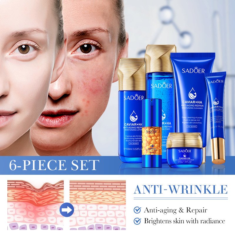 SADOER Caviar Hyaluronic Acid Anti-Aging Repair Skincare Set NO.SD19356 | 6-Piece Facial Care Kit Wholesale - Image 4